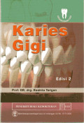 Karies Gigi