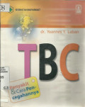 TBC Penyakit & Cara Pencegahannya