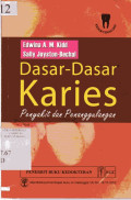 Dasar-dasar Karies Penyakit dan Penanggulangan (Essentials of Dental Carries: The Disease and Its Management)