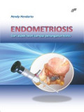 Endometriosis Dari Aspek Teori Sampai Penanganan Klinis