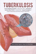 Tuberkulosis